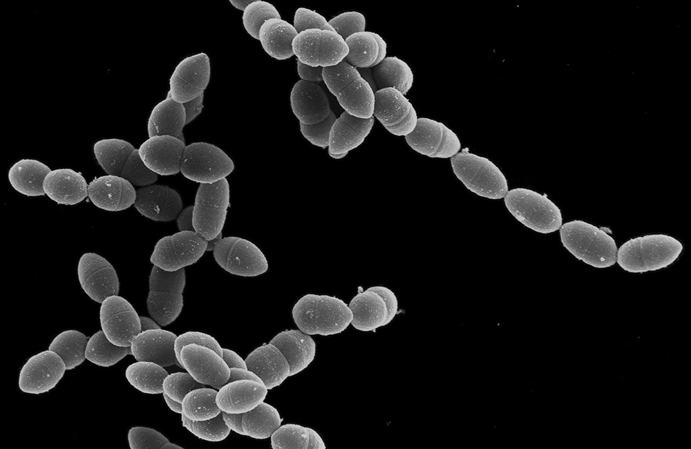 Aufnahme Pneumokokken